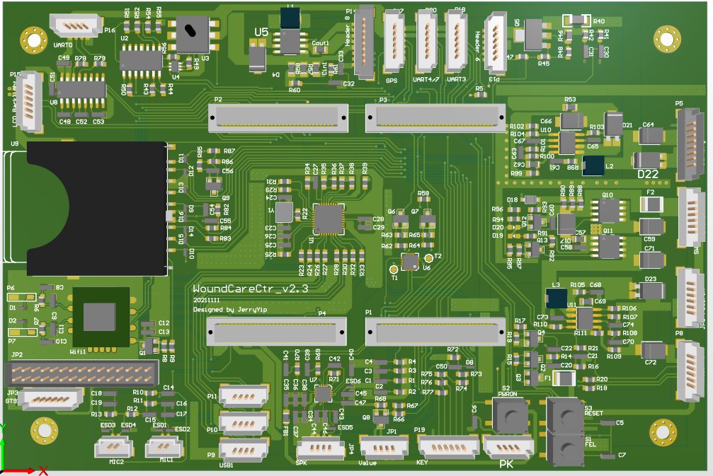 High-Speed Signal Bottom-Layer Routing